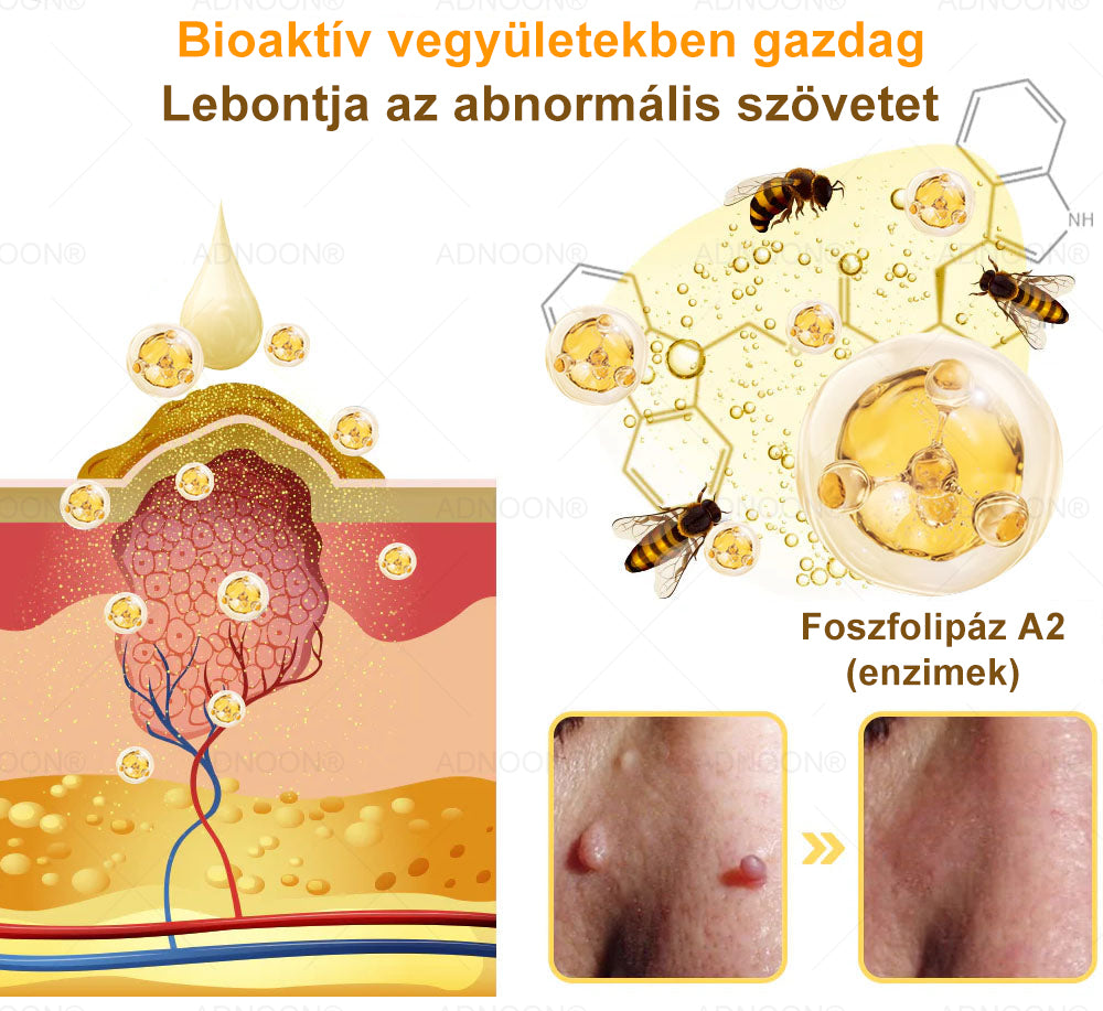 ADNOON® 🌼 7 napos erőteljes bőregészség-javító krém – ajánlja a Magyar Bőrgyógyászati Társaság (MBDT) 👨‍⚕️.