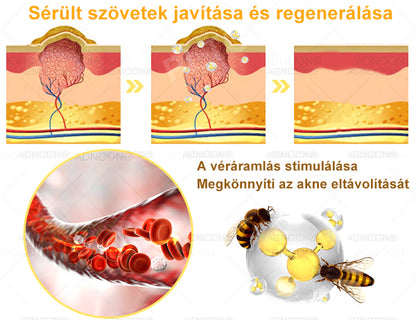 ADNOON® 🌼 7 napos erőteljes bőregészség-javító krém – ajánlja a Magyar Bőrgyógyászati Társaság (MBDT) 👨‍⚕️.